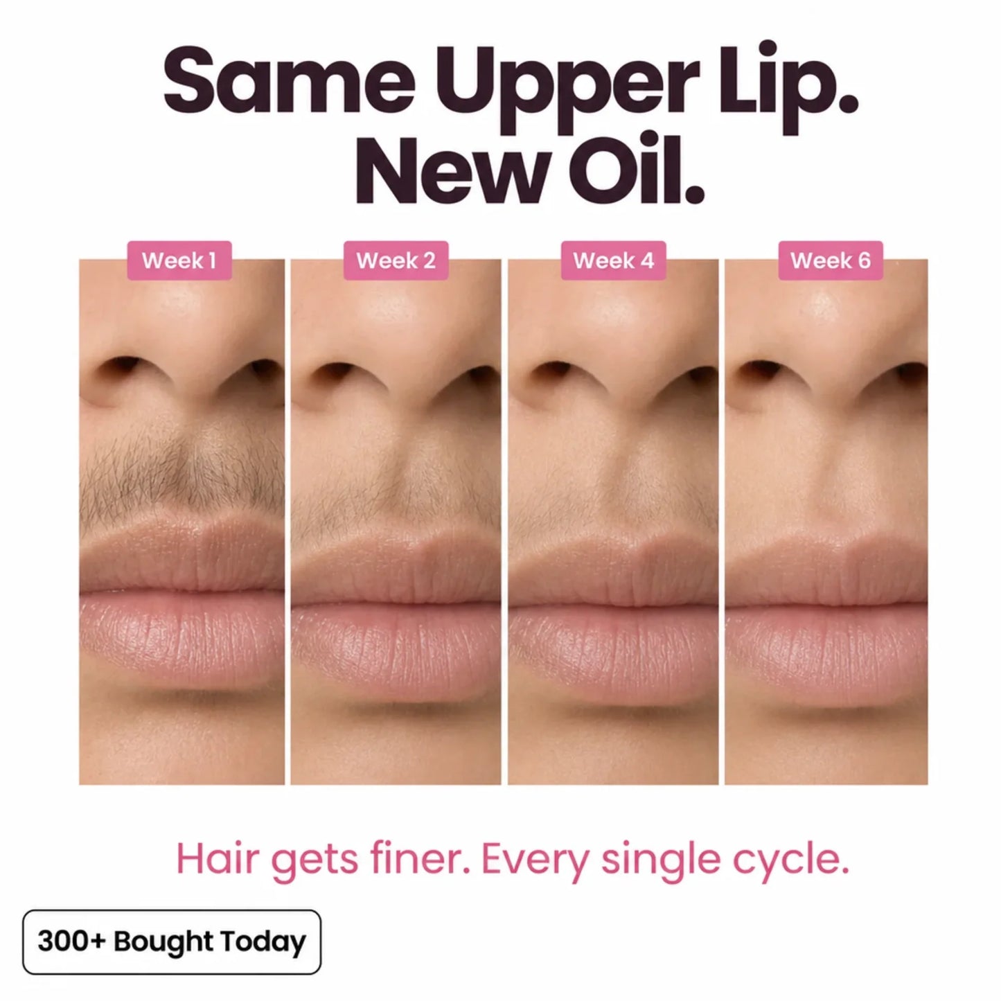Stop Your Bikini Line, Legs, Chin & Upper Lip Hair from Growing Back, Naturally