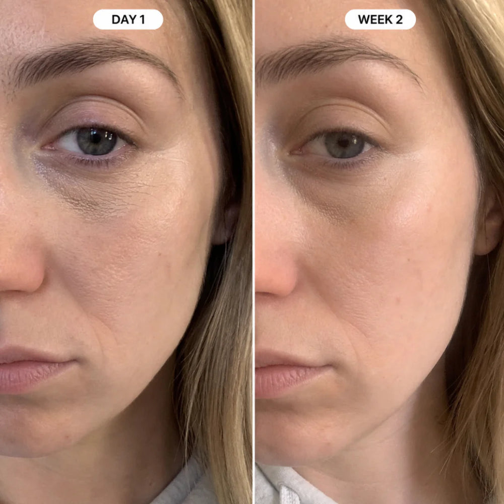 <p><strong>From ‘I look exhausted’ → ‘you look different’</strong></p>