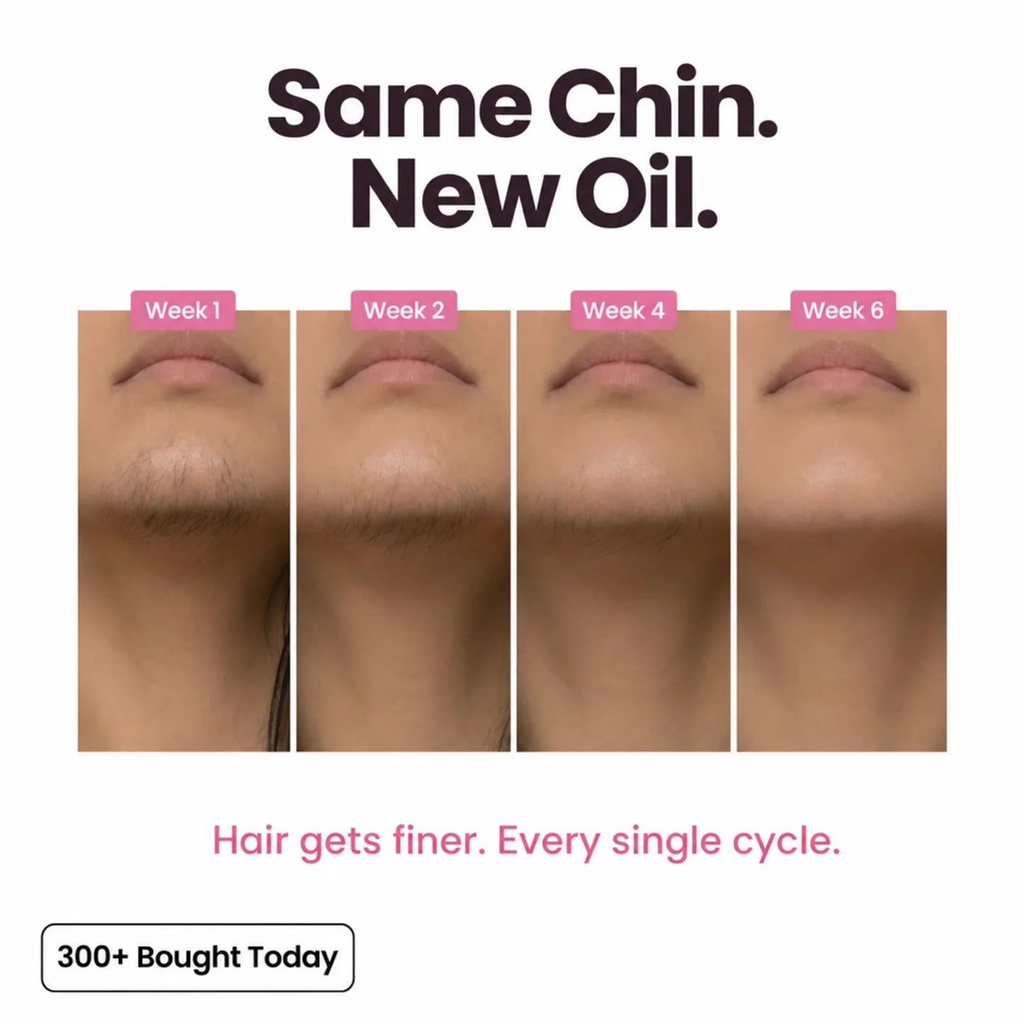 Stop Your Bikini Line, Legs, Chin & Upper Lip Hair from Growing Back, Naturally