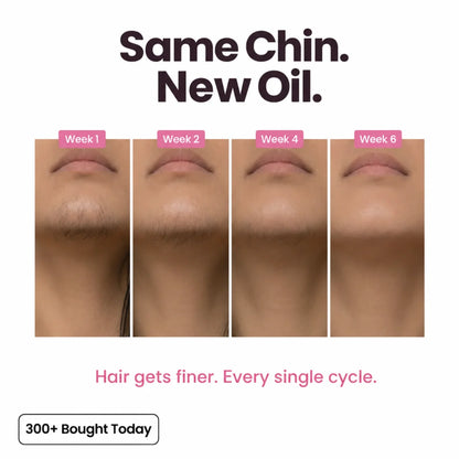 Stop Your Bikini Line, Legs, Chin & Upper Lip Hair from Growing Back, Naturally