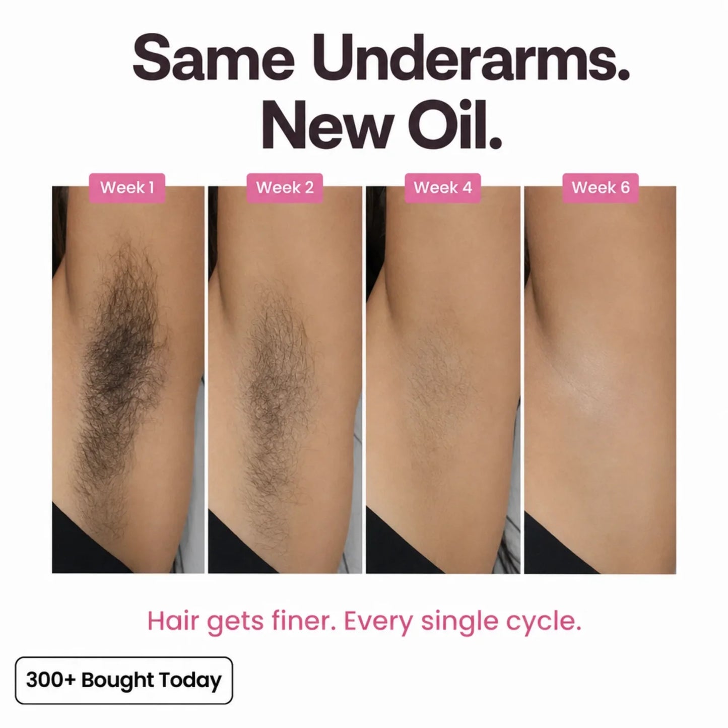 Stop Your Bikini Line, Legs, Chin & Upper Lip Hair from Growing Back, Naturally