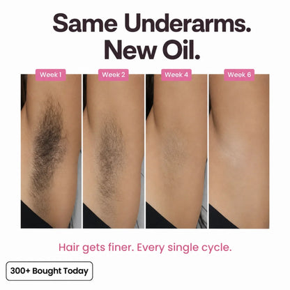 Stop Your Bikini Line, Legs, Chin & Upper Lip Hair from Growing Back, Naturally
