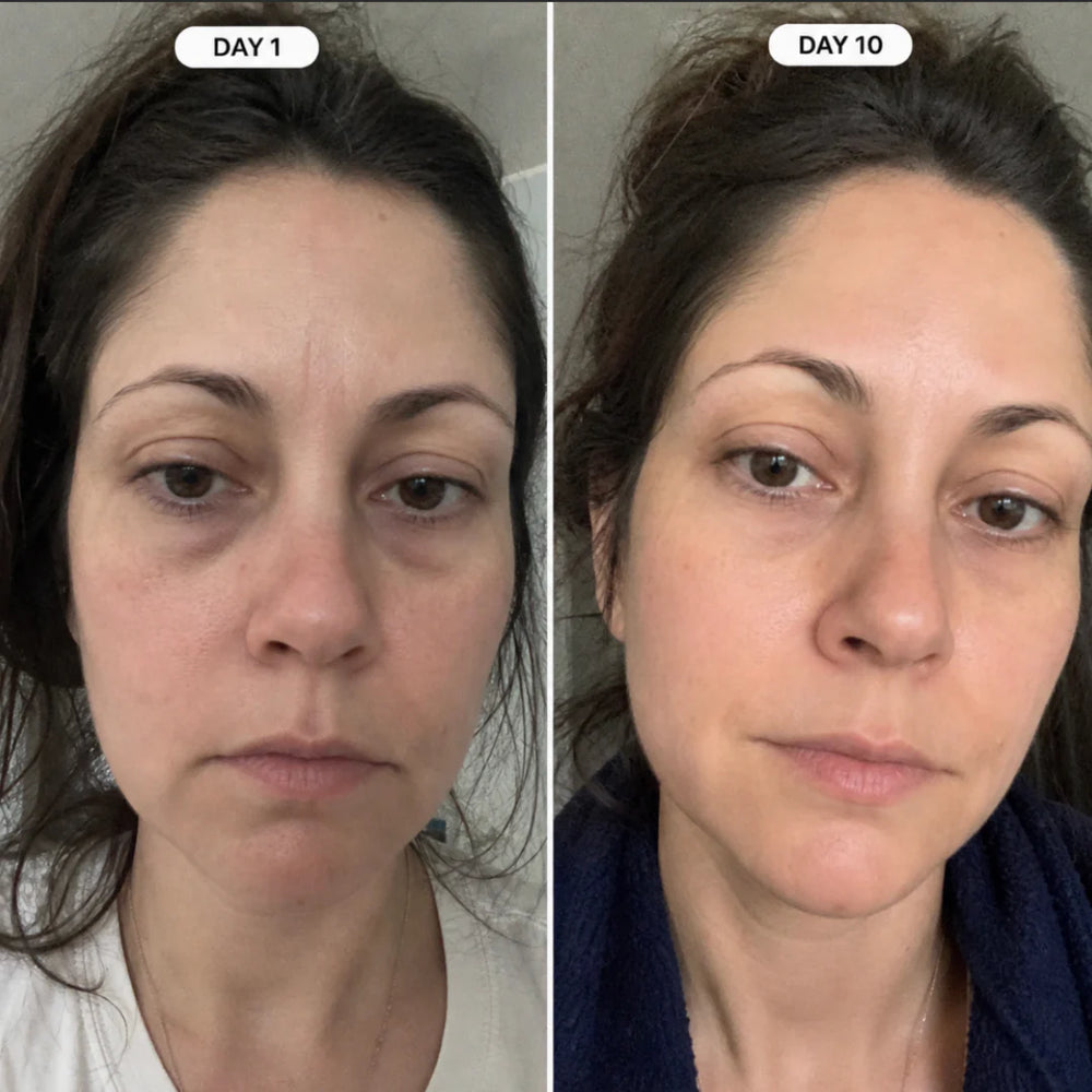 <p><strong>From ‘I look exhausted’ → ‘you look different’</strong></p>