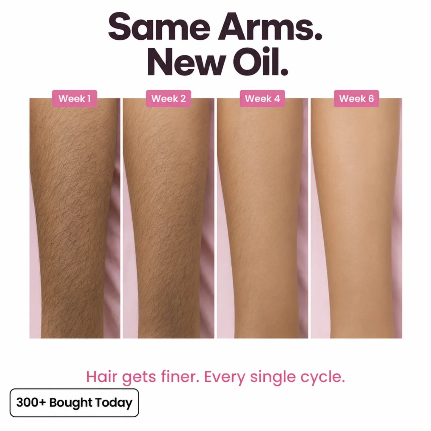 Stop Your Bikini Line, Legs, Chin & Upper Lip Hair from Growing Back, Naturally
