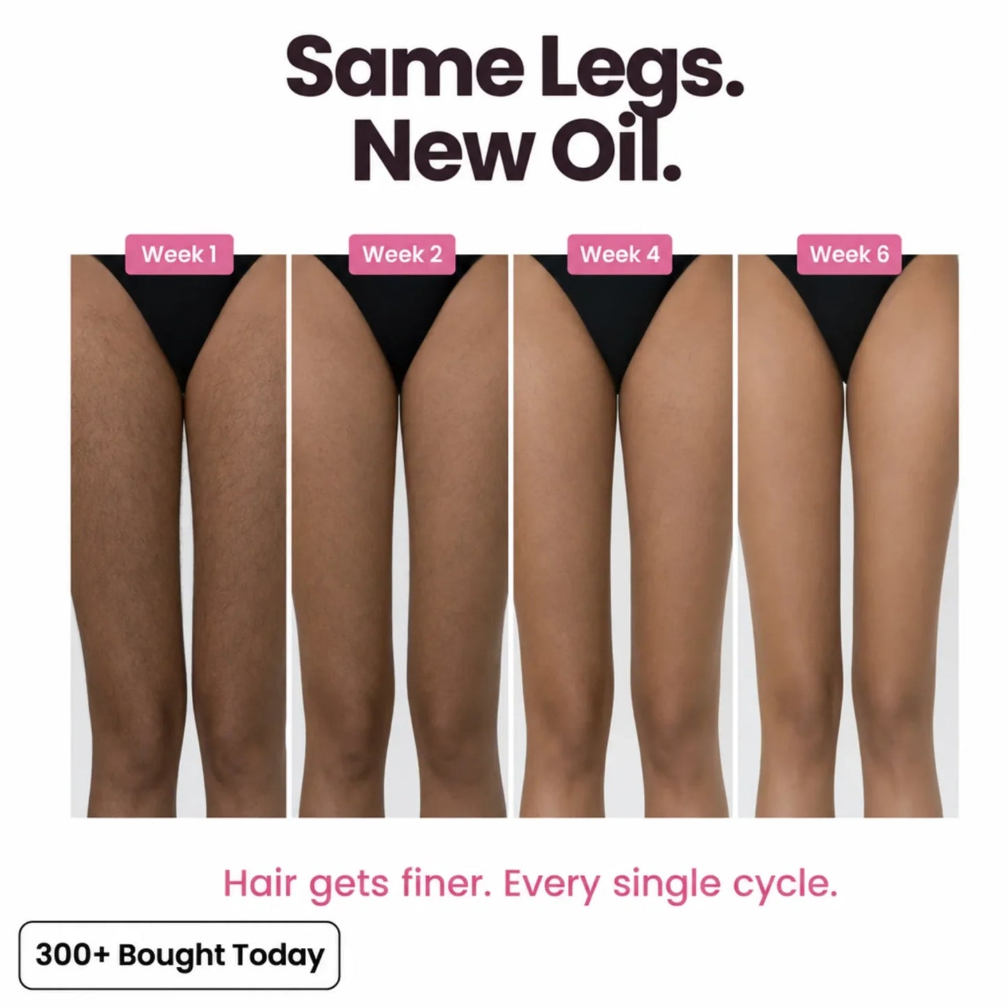 Stop Your Bikini Line, Legs, Chin & Upper Lip Hair from Growing Back, Naturally